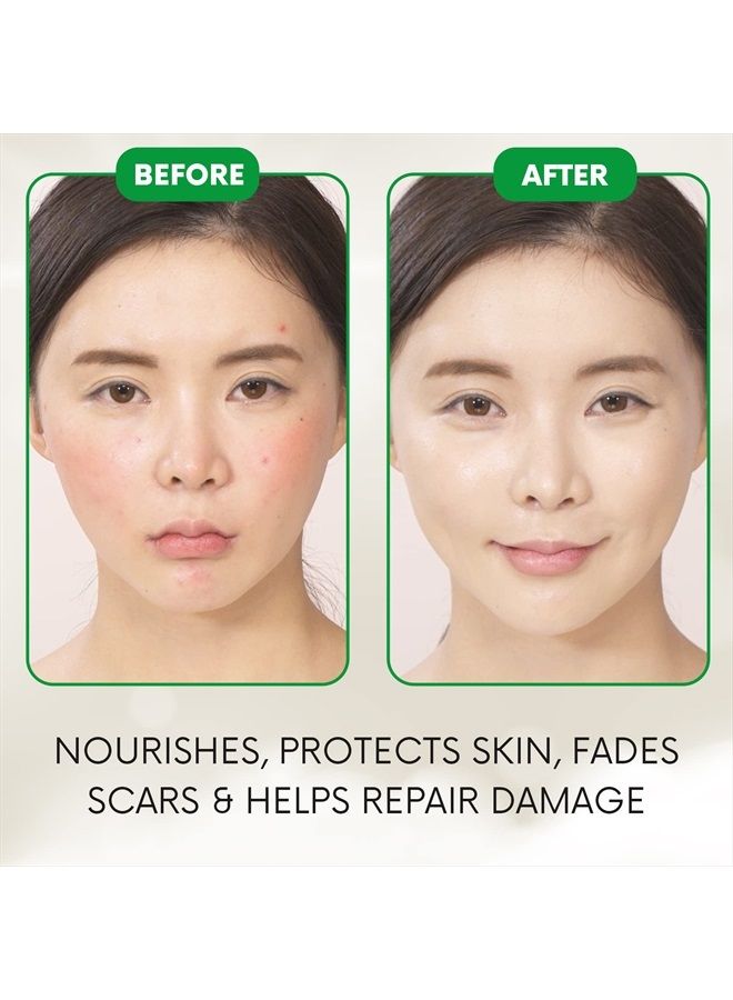 Antique Alive YoungWays Centella Cica Essence Korean Acne Serum for Face – Calming Anti Acne Blemish Ampule Redness Relief Skincare Facial Spot Treatment With Centella Asiatica Extract, Tea Tree Oil - Image 4