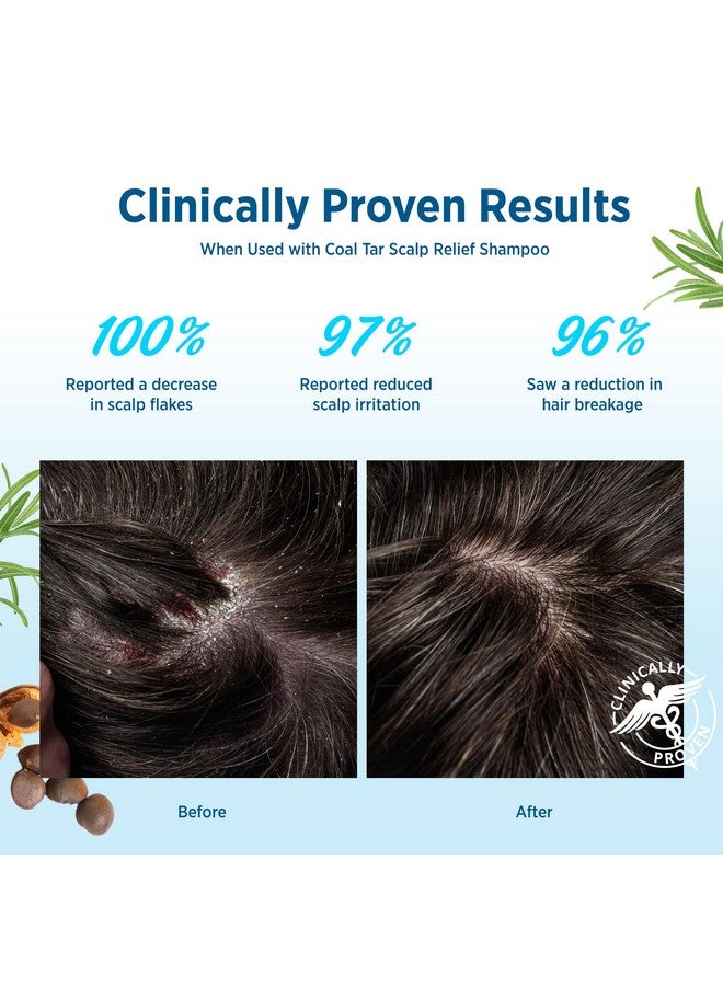 Roycederm Scalp Relief & Moisture Conditioner: Hydrating & Nourishing Formula with Jojoba Oil, Aloe Vera & Camellia Oil, Soothes Dry, Itchy Scalp - Image 5