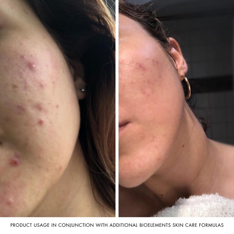 Bioelements Moisture Positive Cleanser - 6 fl oz - Rich Facial Cleanser for Dry Skin - Vegan, Gluten Free - Never Tested on Animals - Image 5