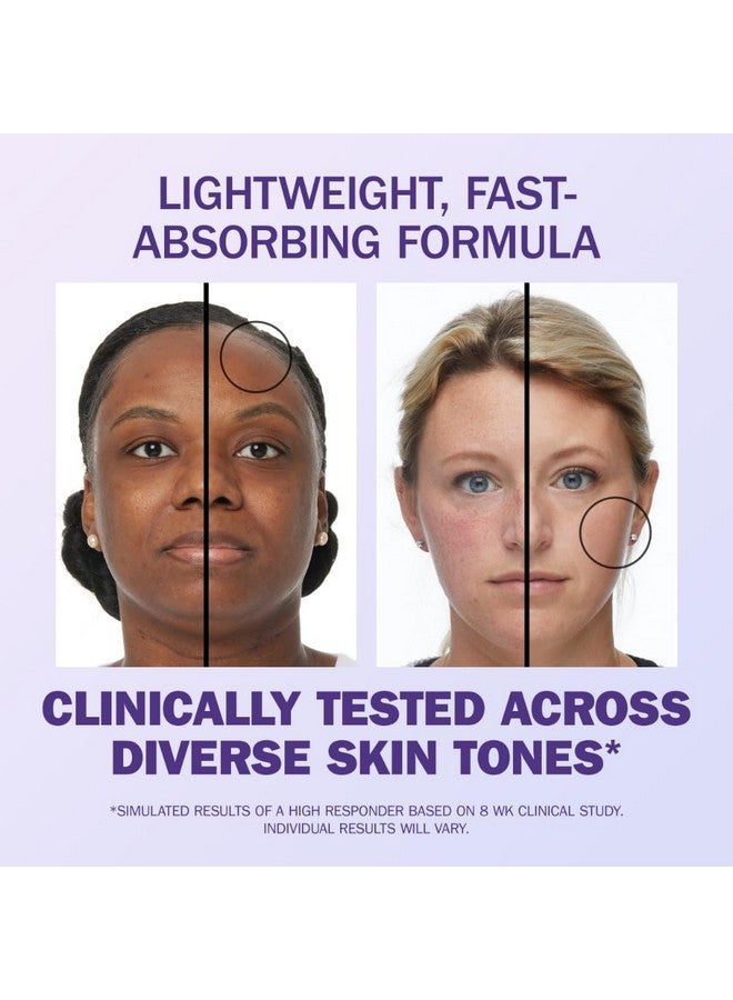 سيروم أولاي سوبر 50 مل (1.7 أونصة) مع النياسيناميد وفيتامين سي وببتيد الكولاجين وحمض ألفا هيدروكسي وفيتامين إي - Image 5