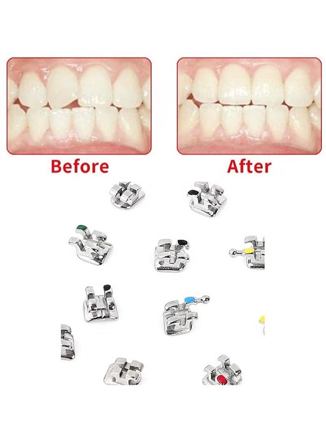 Generic 20 Pieces Orthodontic Brackets for Teeth, Mini Straight Wire Brackets, Metal Brackets, 022 Roth Mini 345 with Hook, Slot Glueable  - Image 4