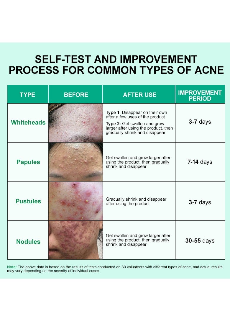 JellyPrim repair blackheads, close pores, shrink pores and remove acne essence 10g - Image 3
