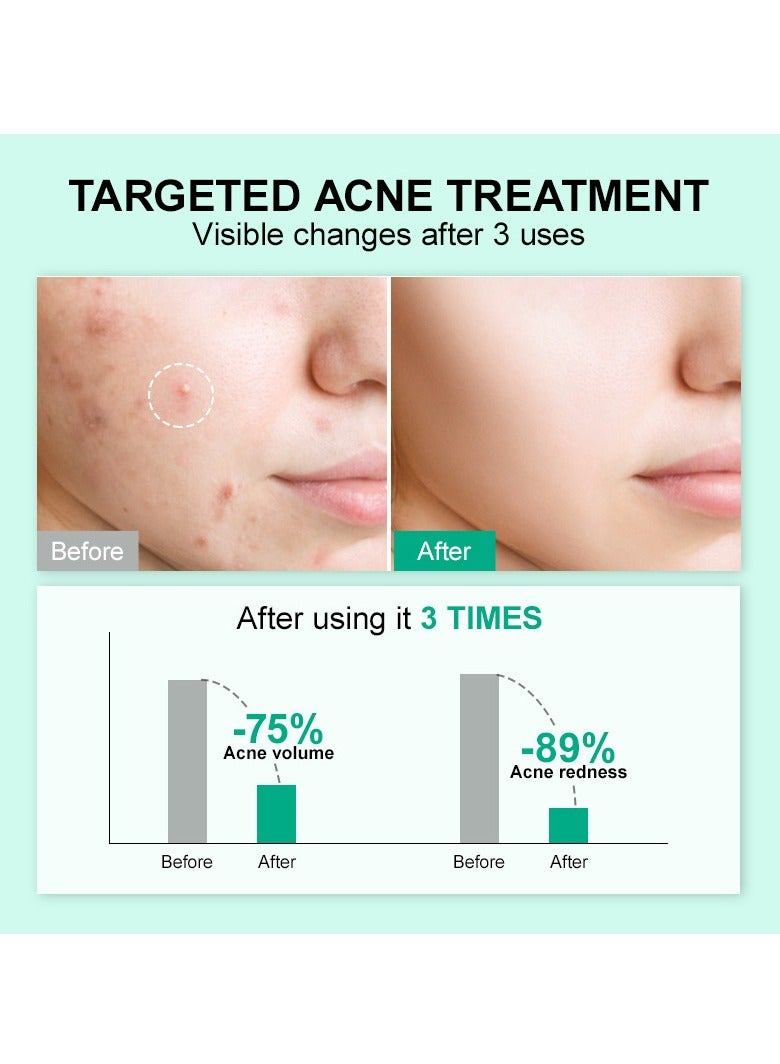 JellyPrim repair blackheads, close pores, shrink pores and remove acne essence 10g - Image 4