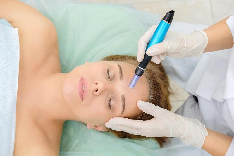 Dr pen Original Derma pen A1- Microneedling 3.0 pin Depth - Anti-Cellulite - Acne Scar Remover - Stretchmark Remover - Maximum Deep - Image 3