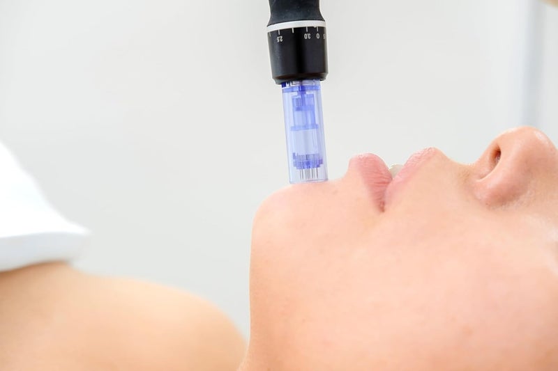 Dr pen Original Derma pen A1- Microneedling 3.0 pin Depth - Anti-Cellulite - Acne Scar Remover - Stretchmark Remover - Maximum Deep - Image 4