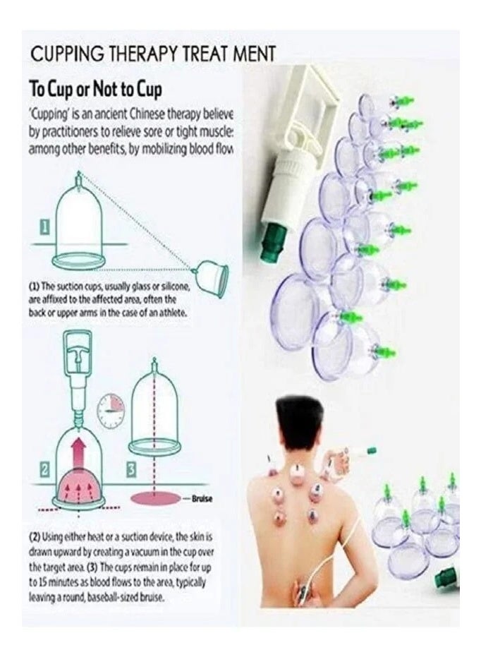 جهاز تدليك الجسم بواسطة أكواب الشفط يحتوي على 12 قطعة - Image 2