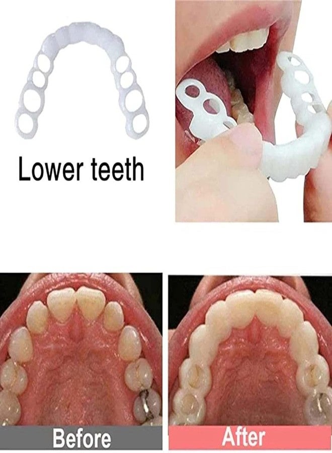 2 Pairs, Temporarily Adjustable, Top and Bottom for Men and Women(Bright White) - Image 4