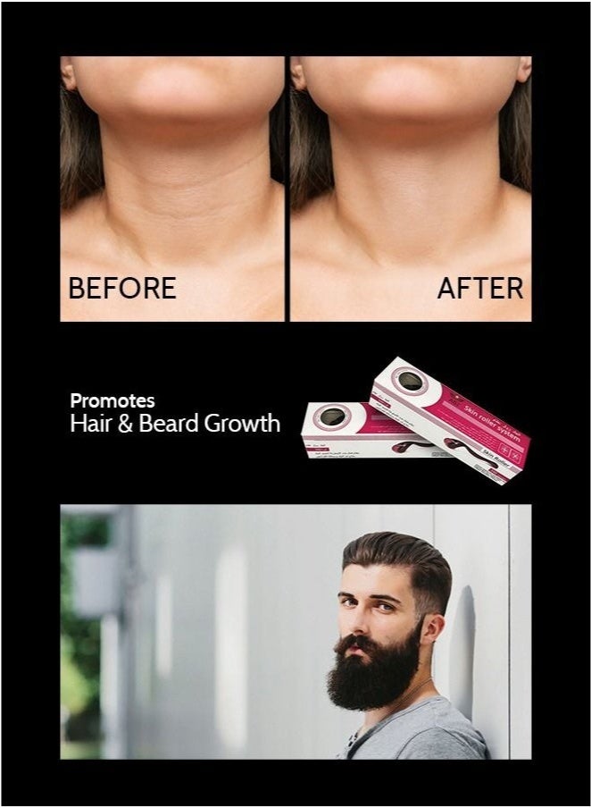 Face Wrinkles And Hair Loss Treatment Roller Black/Pink 5.2x1.1x1.2cm - Image 3
