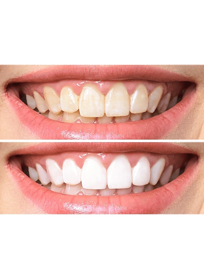 ستيلا وايت لصقات تبييض الاسنان من ستيلا وايت , 6 لصقات - Image 2