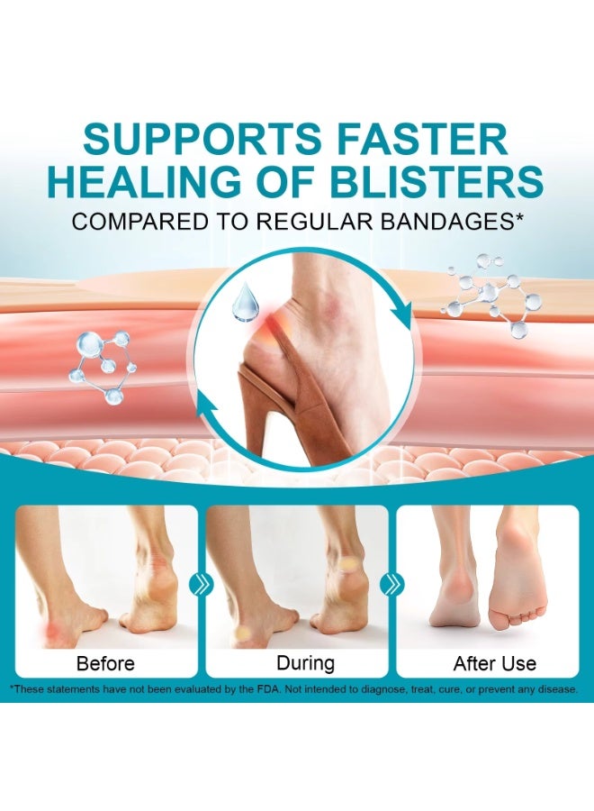 ATOANY 30Pcs Gel Blister Bandages, Hydrocolloid Gel Blister Bandages Pads, Waterproof Adhesive Blisters Bandages, Blister Cushions, Reduce Rubbing & Friction, Gel Blister Cushions for Prevention & Recovery - Image 4
