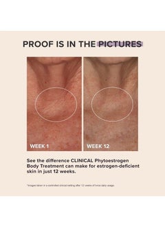 PAULA'S CHOICE CLINICAL Phytoestrogen Elasticity Renewal Body Treatment, Restores Loose, Thinning & Crepey-looking Skin Due to Estrogen Loss, Chest & Decollete Cream, Fragrance-Free, 3.3 Fl Oz  - Image 3