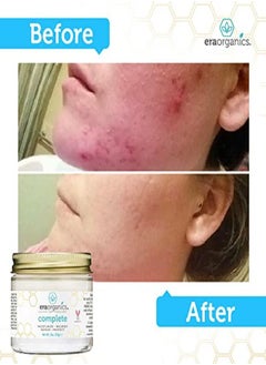 Era Organics Face Moisturizer Cream - Advanced Moisturizing 12-In-1 Dry Skin Cream With Superfood Manuka Honey, Hyaluronic Acid & More To Restore Dry, Sensitive Skin On Face, Neck, Hands.  - Image 4