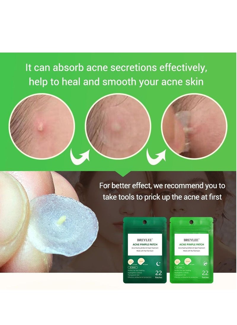 Breylee Acne Pimple Patch Stickers Acne Treatment Pimple Remover Tool Blemish Spot Facial Mask Skin Care Waterproof 22 Patches  - Image 3