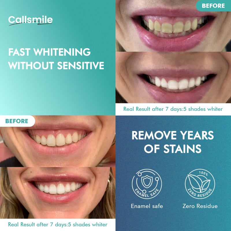 CALLSMILE Whitening Strips for Sensitive Teeth: 16 Treatments Gentle Whitening | Enamel-Safe | Deep Stains Removal | Non-Slip Dry Strips Daily Oral Care, Mint Sea Salt - Image 2