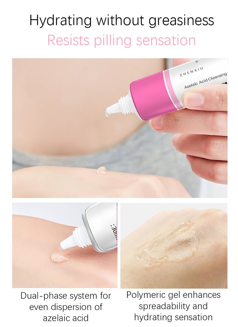 ZHENXIU - Azelaic Acid Cleansing Gel, Acne Treatment Facial Cream with 15% Azelaic Acid to Moisturize, Balance Sebum,and Reduce Redness and Acne Marks, 30ml - Image 1