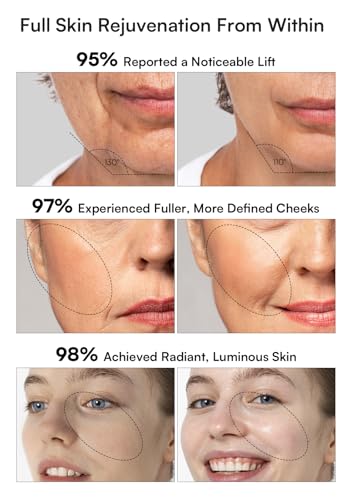 INIA 3-in-1 Red Light Therapy for Face and Neck Beauty Device for Puffiness & Skin Firming Skincare Tool (Black) - Image 5