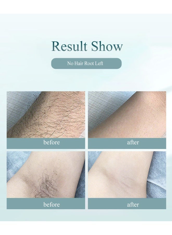 جهاز إزالة الشعر بالليزر المحمول IPL في البيت، جهاز لإزالة الشعر للستات والرجالة، إزالة شعر دائم، 999999 ومضة، وظيفة تبريد بالثلج، ممكن استخدامه على الإبطين، الساقين، الذراعين، خط البكيني والوجه. - Image 3