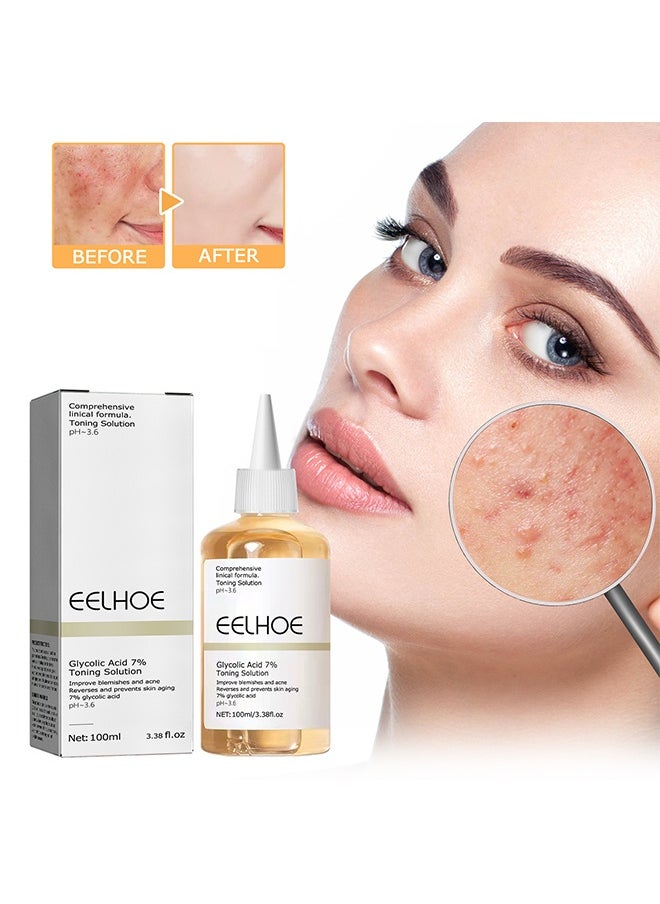 EELHOE Glycolic acid 7% Toning Solution for Removing Acne, Reducing Acne Marks, Removing Closed Mouth Acne, And Repairing The Skin  - Image 1