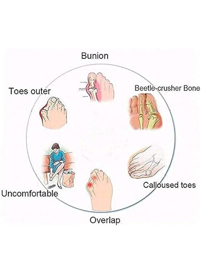 Women's Orthopedic Correction Leather Ring Toe Casual Bunion Slippers Summer Casual Beach Sandals Flat Heel Flip Flops - Image 5