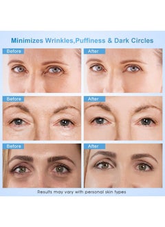 Dongyu Dongyu Caffeine Eye Cream For Wrinkles: Eye Cream Anti Aging For Dark Circles Puffiness Daily Skincare Women Men (15g)  - Image 3