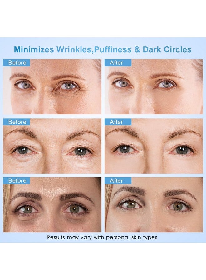 Dongyu Caffeine Eye Cream For Wrinkles: Eye Cream Anti Aging For Dark Circles Puffiness Daily Skincare Women Men (15g) - Image 3
