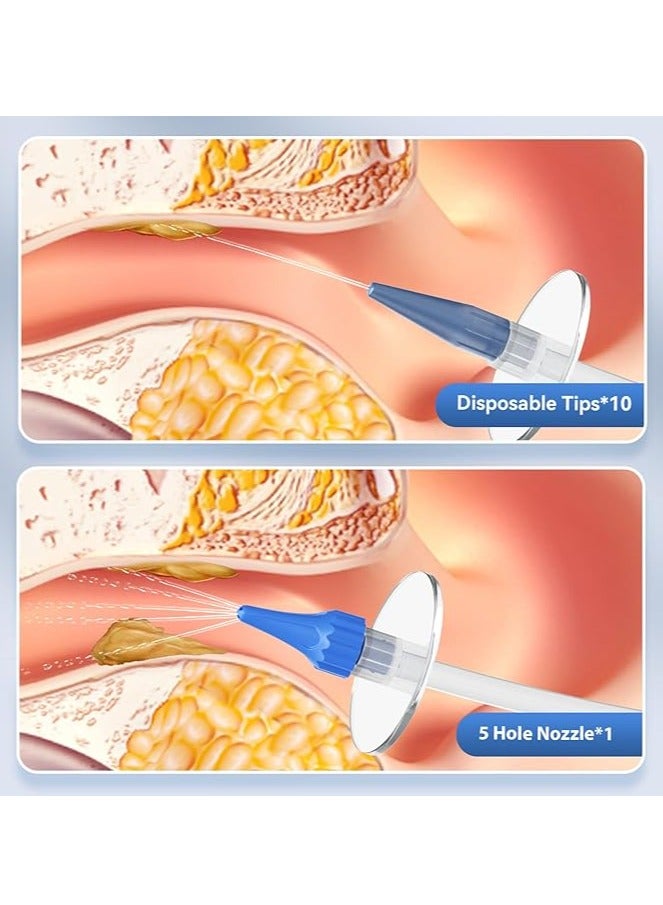 general Earwax Removal Kit, Ear Cleaner for Safe and Effective Ear Rinse Rinse, Complete Ear Cleaning Kit includes 10 replaceable tips for home use - Image 3