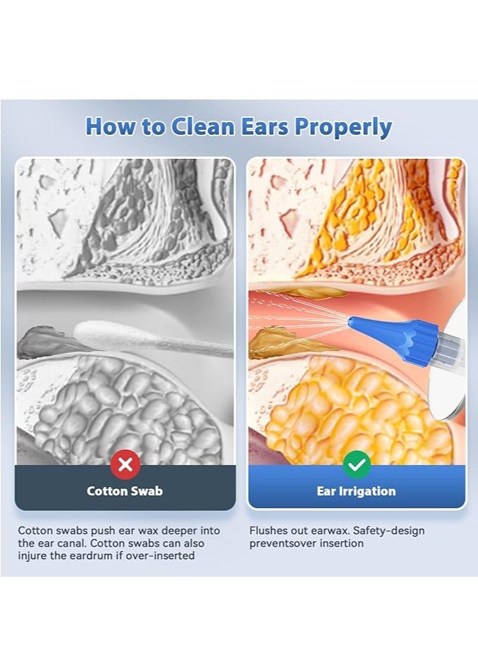 general Earwax Removal Kit, Ear Cleaner for Safe and Effective Ear Rinse Rinse, Complete Ear Cleaning Kit includes 10 replaceable tips for home use - Image 4