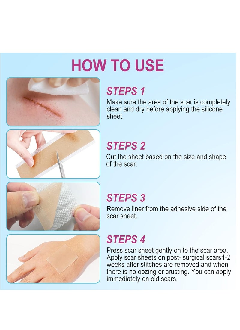Skin Talk Premium Made Scar Sheets Medical Scar Treatment Ultra Thin, Flexible and Reusable for All Skin Types Safe and Effective for Scars and Keloids  - Image 2