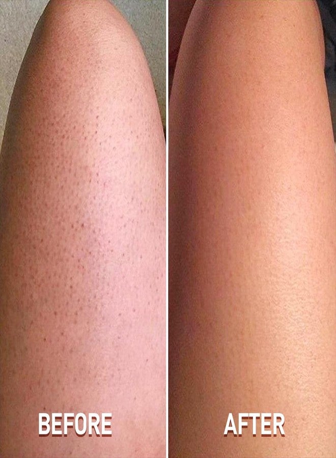 Multibrite Reusable Skin Exfoliating Gloves for All Skin Types, Anti-Bacterial, Deep Exfoliation, Smooths and Brightens Skin, Removes Dead Cells, Perfect Fit, Increases Circulation, Radiant Glow Ideal for Sensitive Skin - Image 5