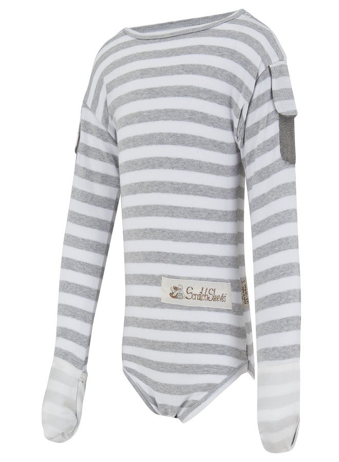 ScratchSleeves | Flip-mitt Bodysuit for Itchy Babies | Grey Stripe | 12-18 Months - Image 1