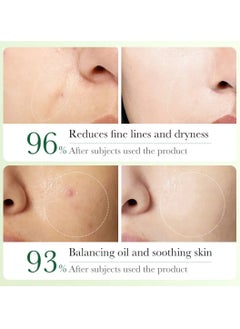 Zozu Olive Oil Antioxidant Anti Wrinkle Soothing Six Pieces Set with Oil Control Cleanser Hydrating Toner Nourishing Eye Cream Soothing Face Essence Whitening Face Toner and Repairing Face Cream Skincare Set  - Image 4