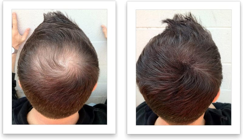 Caboki Hair Building Fiber 25g - Dark Brown - Professional Grade Hair Loss Concealer - Image 2