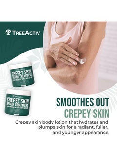 TreeActiv Crepey Skin Repair Treatment, 8Oz, Firming Cream For Face And Neck, Skin Firming And Tightening Lotion With Hyaluronic Acid, Crepey Skin Treatment That Moisturizes Dry Crepe Skin, 500+ Uses  - Image 1