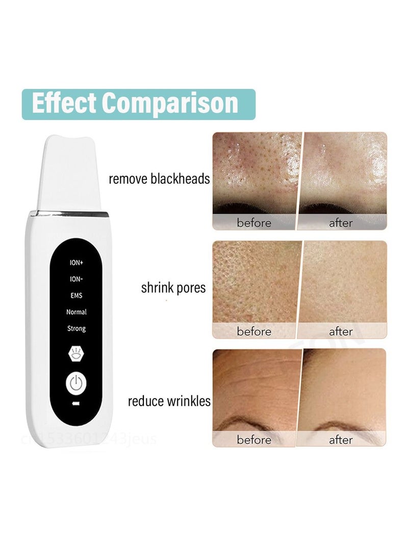 Generic Ultrasonic Skin Scrubber Peeling Blackhead Remover Deep Face Cleaning Ultrasonic Ion Ance Pore Cleaner Facial Shovel Cleanser  - Image 1