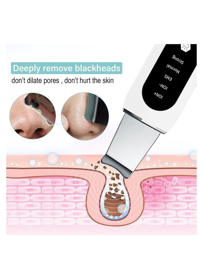 Generic Ultrasonic Skin Scrubber Peeling Blackhead Remover Deep Face Cleaning Ultrasonic Ion Ance Pore Cleaner Facial Shovel Cleanser  - Image 2