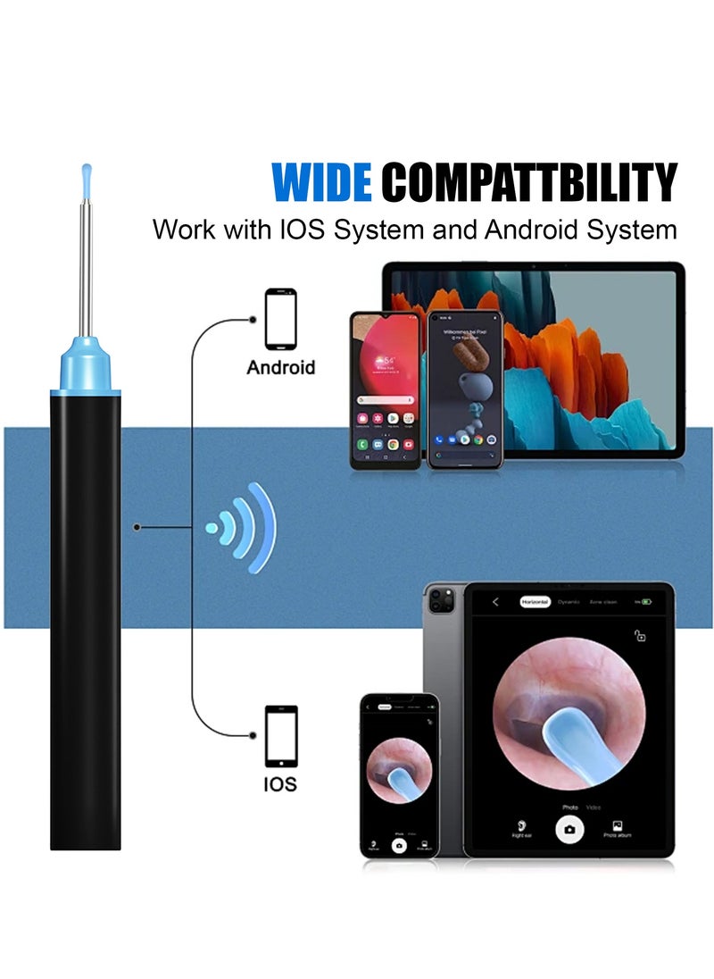 Adando Adando Earwax Removal set Wireless Video Display  - Image 5