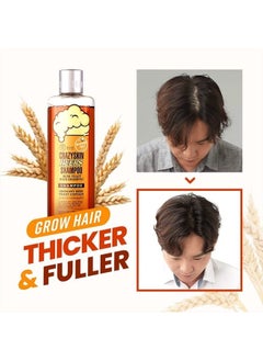 CRAZY SKIN Beer Shampoo & Hair Pack SET | Ready-To-Gift BIOTIN Rich with Beer Yeast for hair loss, Hair Regrowth and Thickening, Biotin shampoo for thinning hair, Sulfate free  - Image 4