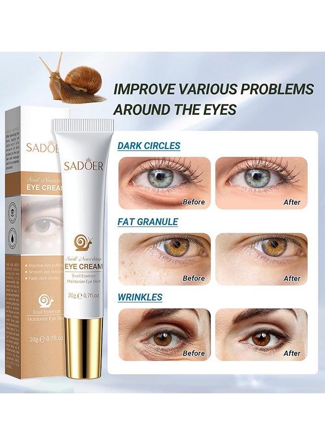 SADOER - Snail Essence Moisturize Eye Cream 20G, Anti Aging, Exquisitely Repair Skin, Moisturize, Fade Eye Lines, Dark Circles And Black Spots, Shrink Pores And Tighten Skin, Moisturizing Eye Serum, Eye Care - Image 1