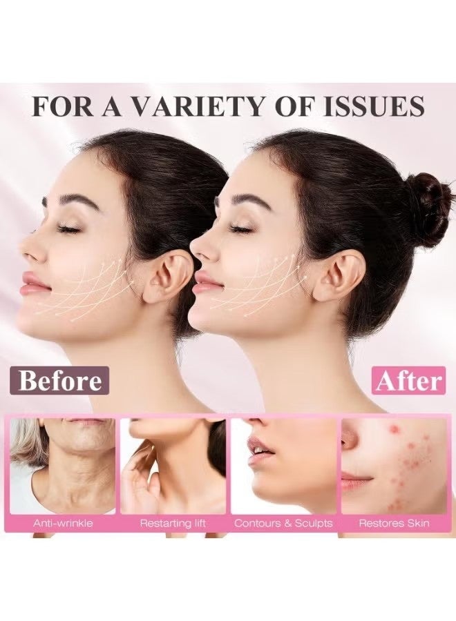 Chin Strap for Sleeping,Adjustable Chin Strap,Jaw Strap,Jawline Shaper,V Line Lifting Mask,Pink - Image 3
