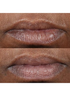 Perricone MD Cold Plasma Plus+ Lip Therapy  - Image 4