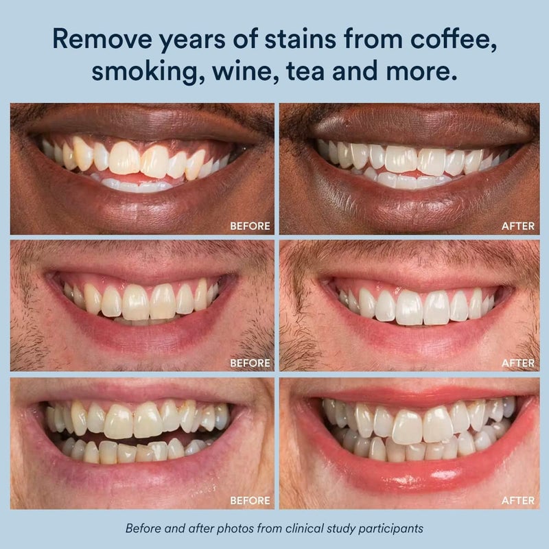 Auraglow Whitening Toothpaste Booster, Add to Toothpaste to Whiten, 9% Hydrogen Peroxide Teeth Whitening Gel Toothpaste, 350+ Whitening Treatments, 6-Month Supply, 2.6oz - Image 4