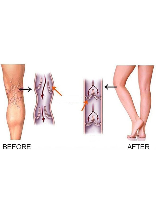 Women's Medical Compression Stockings 15-20mmhg Socks Calf Sleeve - Image 5