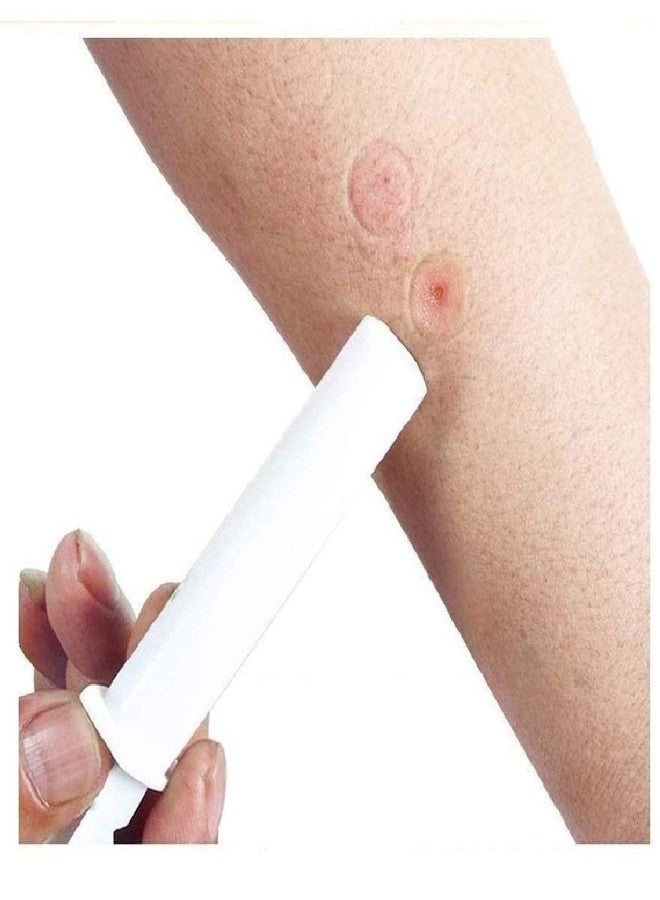 FINEVER 2PK Mosquito Bee Sting Bug Bite Kit Suction Tool Safety Supplies Natural First Aid for Hiking Backpacking Camping - Image 1