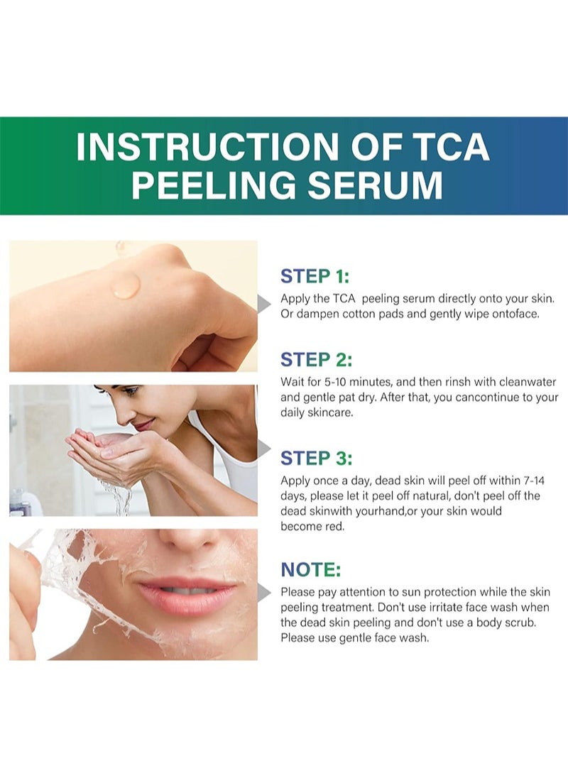 40% TCA Chemical Peeling Serum with Malic and Citric Acid for Dark Skin, Dark Spots and Acne Spots, Natural Skin Care - 30 ml/1 fl oz (TCA 40%)