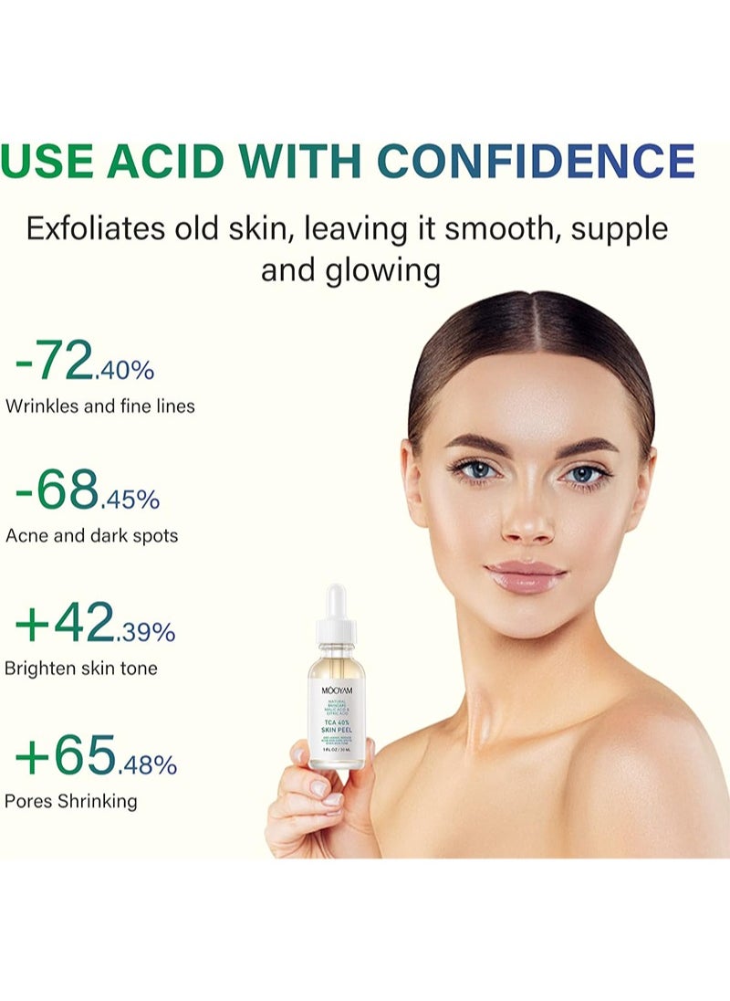 40% TCA Chemical Peeling Serum with Malic and Citric Acid for Dark Skin, Dark Spots and Acne Spots, Natural Skin Care - 30 ml/1 fl oz (TCA 40%)