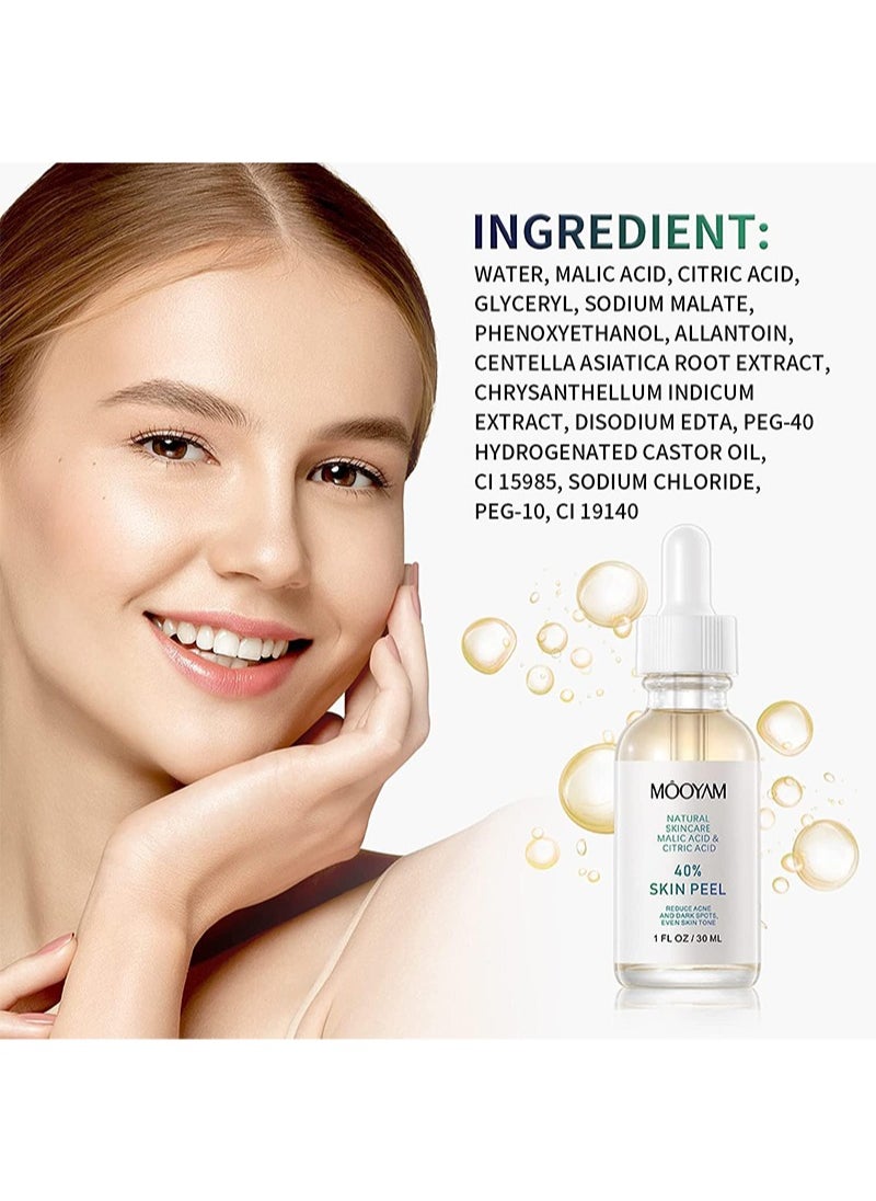 40% TCA Chemical Peeling Serum with Malic and Citric Acid for Dark Skin, Dark Spots and Acne Spots, Natural Skin Care - 30 ml/1 fl oz (TCA 40%)