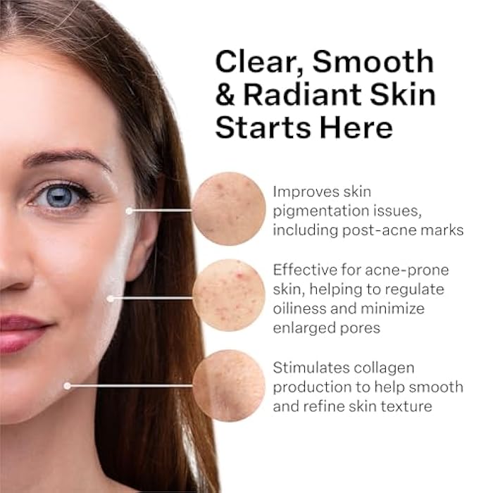 A313 كريم الوجه الخفيف فيتامين أ (ريتينويد) من صيدلية A313 الفرنسية لمكافحة الشيخوخة، تقليل التجاعيد، منع ظهور حب الشباب، والتصبغ المفرط - العناية بالبشرة لبشرة ناعمة ومشرقة - 50 جرام - Image 3