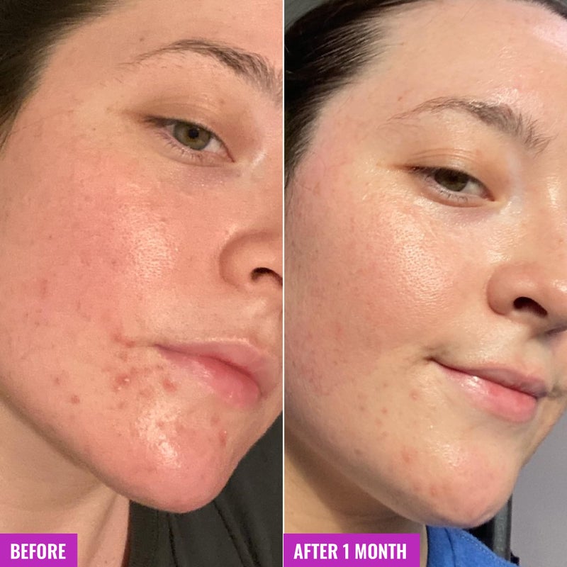 Good Molecules صابونة Good Molecules Clarify and Cleanse Bar - صابونة خالية من الصابون تحتوي على حمض الساليسيليك وBHA وشجرة الشاي وطين الكاولين لترطيب البشرة - للعناية بالبشرة والوجه والجسم - Image 5