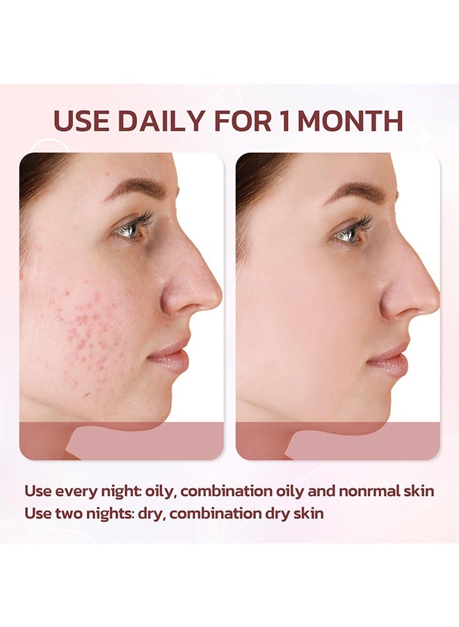 BARUBT Pimple Warrior Salicylic Acid Acne Drying Lotion-Acne Repair,Promotes Acne Removal,For All Skin Types 40ml - Image 4