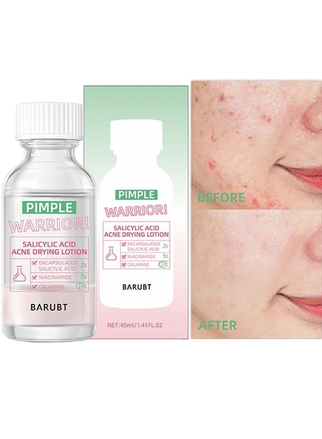 BARUBT Pimple Warrior Salicylic Acid Acne Drying Lotion-Acne Repair,Promotes Acne Removal,For All Skin Types 40ml - Image 1
